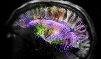 cerebro